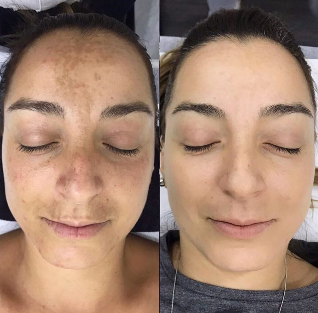 532063fb860b7578c8179d5e0c193ee7