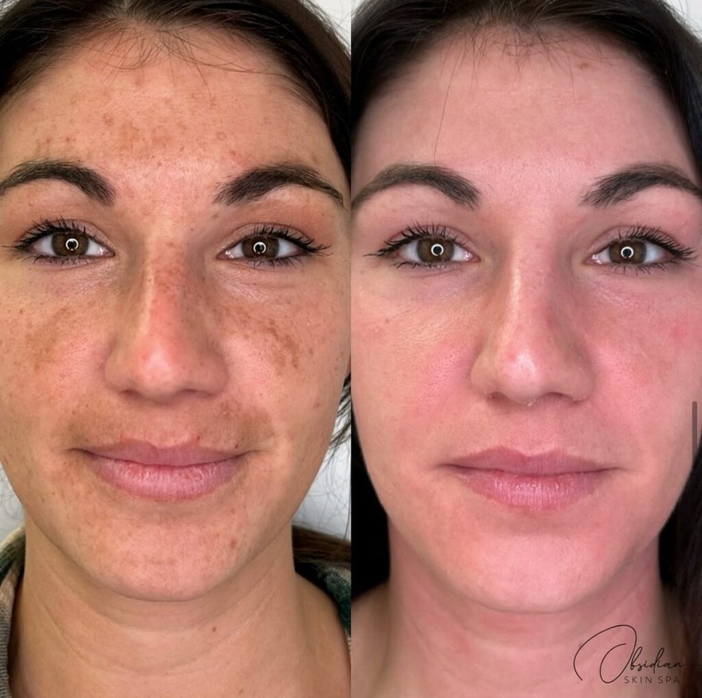 8935b1f329a070a2e613f6cb4d79891a